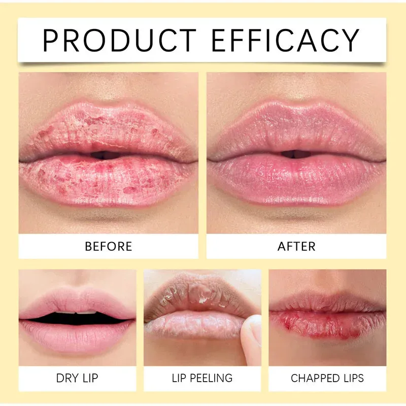 Dark Lip Lightening Balm