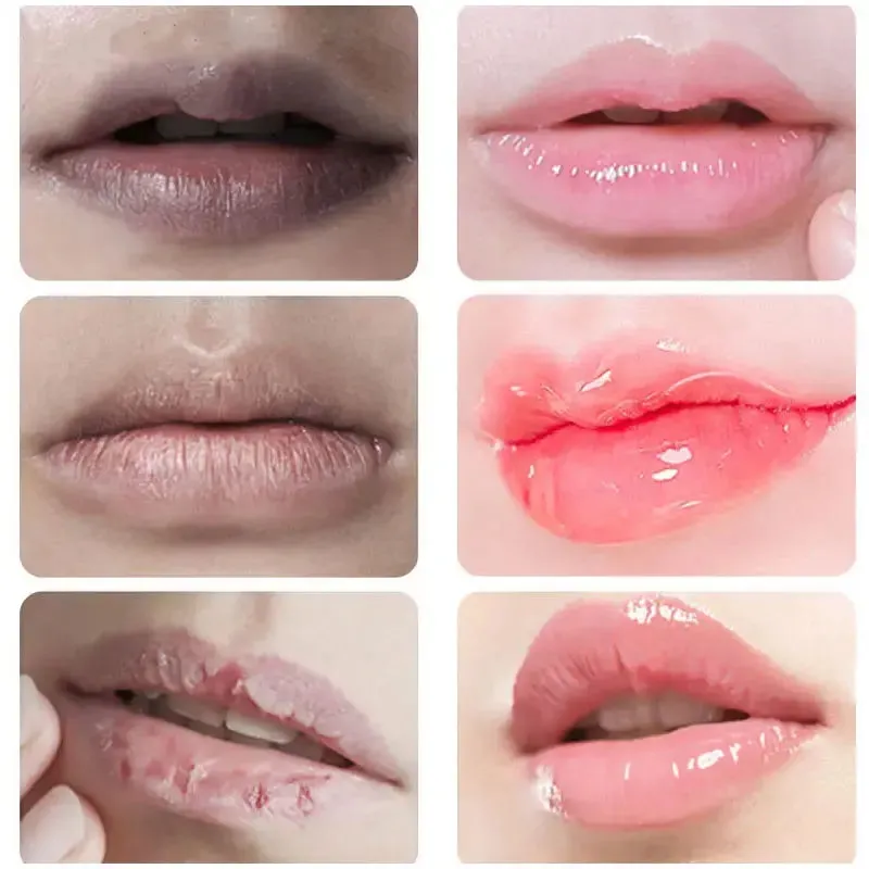 Dark Lip Lightening Balm